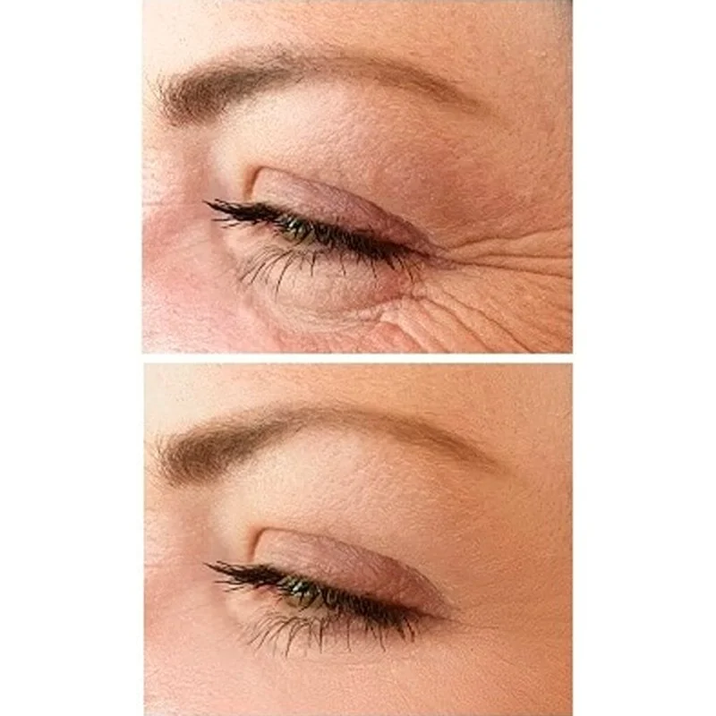 No.1 Liftingujący krem pod oczy 15 ml