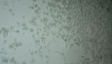 Efektywne metody walki z pleśnią na ścianie