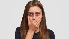 Jak radzić sobie z siniakami za pomocą sprawdzonych naturalnych metod